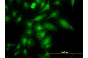 Immunofluorescence of monoclonal antibody to TRAPPC4 on HeLa cell.