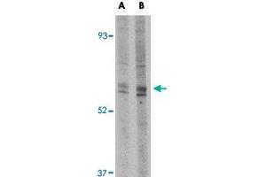 Western blot analysis of Trim30 in mouse heart tissue lysate with Trim30 polyclonal antibody  at (A) 1 and (B) 2 ug/mL . (TRIM30 Antikörper  (N-Term))