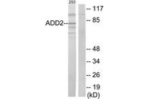 Western Blotting (WB) image for anti-Adducin 2 (Beta) (ADD2) (AA 471-520) antibody (ABIN2889855) (ADD2 Antikörper  (AA 471-520))