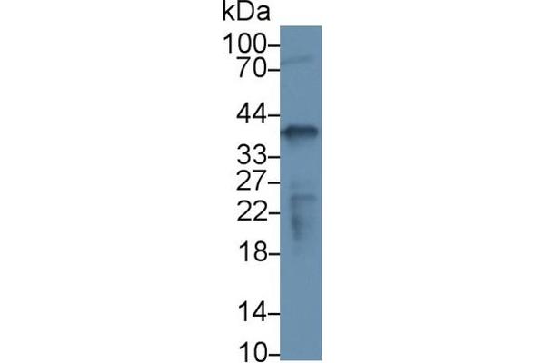 NPM1 Antikörper  (AA 20-154)