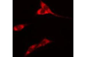 ABIN6274564 staining Hela cells by IF/ICC. (14-3-3 eta Antikörper  (Internal Region))