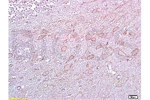 Formalin-fixed and paraffin embedded rat brain tissue labeled with :  Anti-5-HTR2A Polyclonal Antibody, unconjugated (ABIN737016)  at 1: 200 followed by incubation with conjugated secondary antibody and DAB staining (HTR2A Antikörper  (AA 65-160))