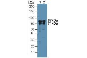 Western blot analysis of (1) Human A549 Cells and (2) Human Liver Tissue. (Integrin beta 3 Antikörper  (AA 135-377))