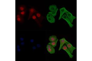 ABIN6256486 and ABIN6274031 staining Hela cells(heat shock treatment) by IF/ICC. (HIST1H1E Antikörper  (pThr18))