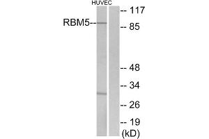 Western blot analysis of extracts from HUVEC cells, using RBM5 antibody. (RBM5 Antikörper  (Internal Region))