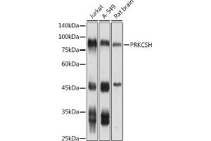 Western blot analysis of extracts of various cell lines, using PRKCSH antibody (ABIN1682300, ABIN3018458 and ABIN7101614) at 1:1000 dilution.