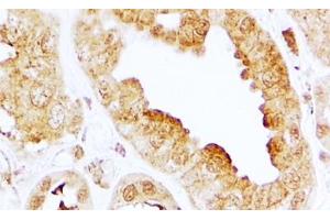 ABIN5539719 (2µg/ml) staining of paraffin embedded Human Kidney. (S1PR3 Antikörper  (Internal Region))