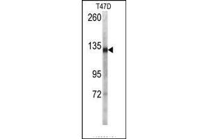 Image no. 1 for anti-Desmoglein 2 (DSG2) (N-Term) antibody (ABIN360106) (Desmoglein 2 Antikörper  (N-Term))