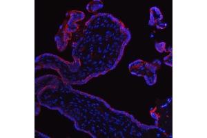 IF analysis of ALPP using anti-ALPP antibody (ABIN4886453). (PLAP Antikörper  (C-Term))