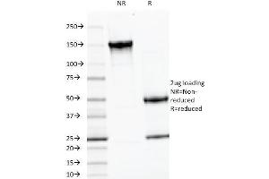 SDS-PAGE Analysis Purified LH-beta Mouse Monoclonal Antibody (LHb/1214). (LHB Antikörper)