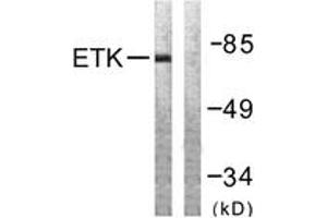 Western Blotting (WB) image for anti-BMX Non-Receptor Tyrosine Kinase (BMX) (AA 532-581) antibody (ABIN2888766) (BMX Antikörper  (AA 532-581))