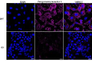Immunocytochemical staining of HeLa cells using Oxoglutarate receptor 1 antibody (ABIN7799714), 1:1,000), Top panel: wild-type (WT), Bottom panal: Oxoglutarate receptor 1 shRNA knockdown (KD). (Rekombinanter OXGR1 Antikörper)
