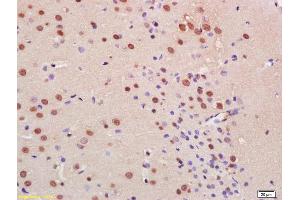 Formalin-fixed and paraffin embedded rat brain with labeled Anti-C9orf72 Polyclonal Antibody, Unconjugated (ABIN1386141) at 1:200, followed by conjugation to the secondary antibody and DAB staining (C9ORF72 Antikörper  (AA 391-481))