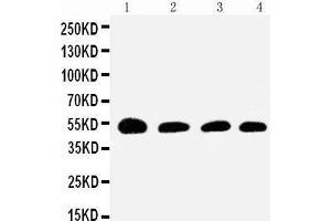 Anti-Antithrombin III antibody, Western blotting Lane 1: Rat Testis Tissue Lysate Lane 2: SMMC Cell Lysate Lane 3: JURKAT Cell Lysate Lane 4: RAJI Cell Lysate (SERPINC1 Antikörper  (N-Term))