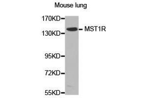 Western Blotting (WB) image for anti-Macrophage Stimulating 1 Receptor (C-Met-Related tyrosine Kinase) (MST1R) antibody (ABIN2650934) (MST1R Antikörper)