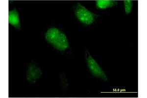 Immunofluorescence of monoclonal antibody to BATF2 on HeLa cell. (BATF2 Antikörper  (AA 1-189))