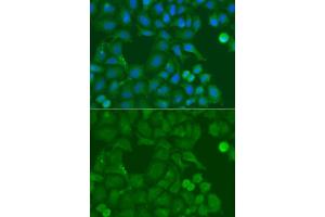 Immunofluorescence analysis of A549 cell using SSX5 antibody. (SSX5 Antikörper)