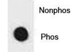 Dot blot analysis of phospho-IKK beta antibody.