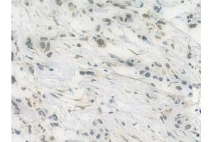 ABIN6258465 and ABIN6275072 at 1/100 staining human normal liver tissue by IHC-P.