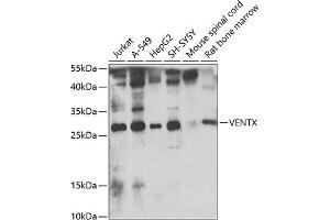 Western blot analysis of extracts of various cell lines, using VENTX antibody  at 1:1000 dilution. (VENTX Antikörper  (AA 1-258))