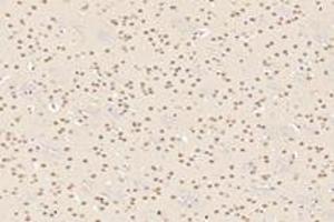 Immunohistochemistry (Paraffin-embedded Sections) (IHC (p)) image for anti-T-Box 19 (TBX19) antibody (ABIN7075815)