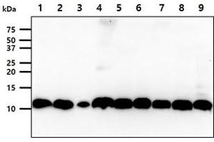 The cell lysates (40ug) were resolved by SDS-PAGE, transferred to PVDF membrane and probed with anti-human S100A11 antibody (1:1000). (S100A11 Antikörper)