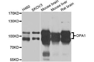 Western blot analysis of extracts of various cell lines, using OPA1 antibody. (OPA1 Antikörper  (AA 661-960))