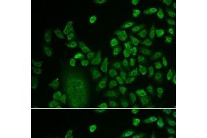 Immunofluorescence analysis of HeLa cells using LSM4 Polyclonal Antibody at dilution of 1:50. (LSM4 Antikörper)