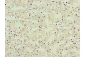 Immunohistochemistry (IHC) image for anti-NADH Dehydrogenase (Ubiquinone) 1 alpha Subcomplex, 12 (NDUFA12) (AA 1-145) antibody (ABIN7160891)
