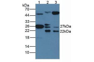 Western blot analysis of (1) Rat Serum Tissue, and (2) Rat Spleen Tissue, using Rabbit Anti-Human HSP27 Antibody (1 µg/ml) and HRP-conjugated Rabbit Anti-Mouse antibody ( (HSP27 Antikörper  (AA 2-205))