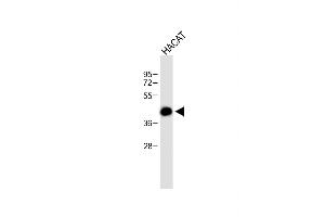 Anti-RCO Antibody (N-term) at 1:500 dilution + HACAT whole cell lysate Lysates/proteins at 20 μg per lane. (MARCO Antikörper  (AA 13-40))