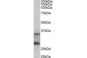 Western Blotting (WB) image for anti-U6 SnRNA Biogenesis 1 (USB1) (Internal Region) antibody (ABIN2465002) (C16orf57 Antikörper  (Internal Region))