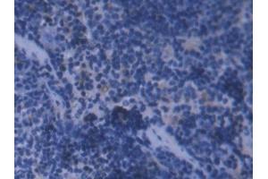 IHC-P analysis of Mouse Spleen Tissue, with DAB staining. (FTL Antikörper  (AA 5-183))