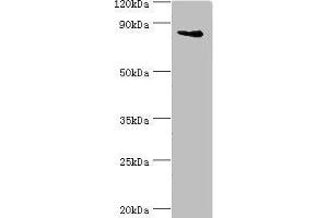 Western blot All lanes: Interleukin enhancer-binding factor 3 antibody at 3 μg/mL + HepG2 whole cell lysate Secondary Goat polyclonal to rabbit IgG at 1/10000 dilution Predicted band size: 96, 77, 83, 76, 75 kDa Observed band size: 96 kDa (Interleukin enhancer-binding factor 3 (ILF3) (AA 785-894) Antikörper)