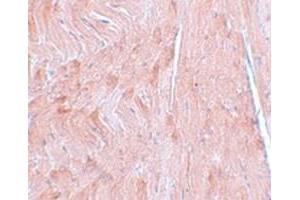Immunohistochemical staining of mouse heart tissue with REEP3 polyclonal antibody  at 5 ug/mL dilution. (REEP3 Antikörper  (C-Term))