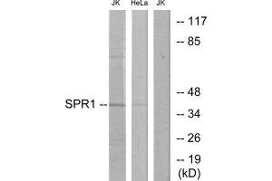 Western Blotting (WB) image for anti-Psoriasis Susceptibility 1 Candidate 2 (PSORS1C2) (C-Term) antibody (ABIN1849648) (SPR1 Antikörper  (C-Term))