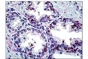 Human Prostate: Formalin-Fixed, Paraffin-Embedded (FFPE) (ARTN Antikörper  (Internal Region))