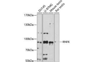 Western blot analysis of extracts of various cell lines, using RNF6 antibody (ABIN7270075) at 1:1000 dilution.