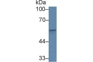 Western Blot; Sample: Human Serum; Primary Ab: 1µg/ml Rabbit Anti-Human CFP Antibody Second Ab: 0. (CFP Antikörper  (AA 65-190))