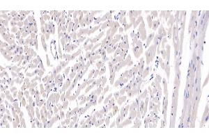 Immunohistochemistry (IHC) image for anti-Secreted Frizzled-Related Protein 1 (SFRP1) (AA 8-153) antibody (ABIN7436171)