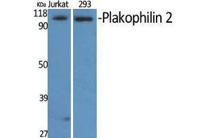 Western Blot (WB) analysis of Jurkat and 293 cells using Plakophilin 2 Polyclonal Antibody. (Plakophilin 2 Antikörper  (C-Term))