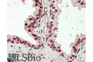 ABIN570834 (3. (Homeobox D13 Antikörper  (Internal Region))