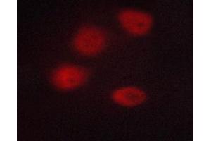 ABIN6267233 staining A549 cells by ICC/IF. (HDAC3 Antikörper  (pSer424))