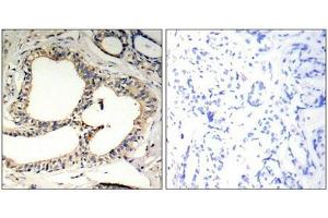 Immunohistochemistry (IHC) image for anti-Nuclear Factor of kappa Light Polypeptide Gene Enhancer in B-Cells Inhibitor, epsilon (NFKBIE) (pSer22) antibody (ABIN7138486)