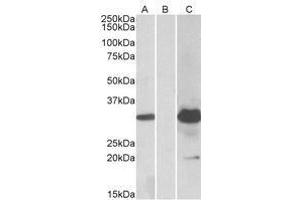 HEK293 lysate (10 µg protein in RIPA buffer) overexpressing Human KCTD11 with DYKDDDDK tag probed with AP23752PU-N (1. (KCTD11 Antikörper  (Internal Region))
