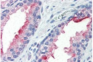 Human Prostate (formalin-fixed, paraffin-embedded) stained with FOLH1 antibody ABIN364300 at 10 ug/ml followed by biotinylated anti-mouse IgG secondary antibody ABIN481714, alkaline phosphatase-streptavidin and chromogen. (PSMA Antikörper)