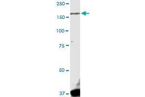 LRRK1 MaxPab rabbit polyclonal antibody. (LRRK1 Antikörper  (AA 1-261))