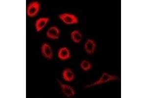 Immunofluorescent analysis of PDE1B staining in MCF7 cells. (PDE1B Antikörper)