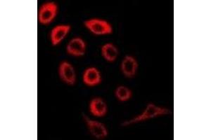 Immunofluorescent analysis of PDE1B staining in MCF7 cells.