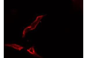 ABIN6276650 staining  Hela cells by IF/ICC. (TYR Antikörper  (C-Term))